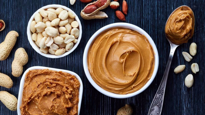 migrain food migrain food