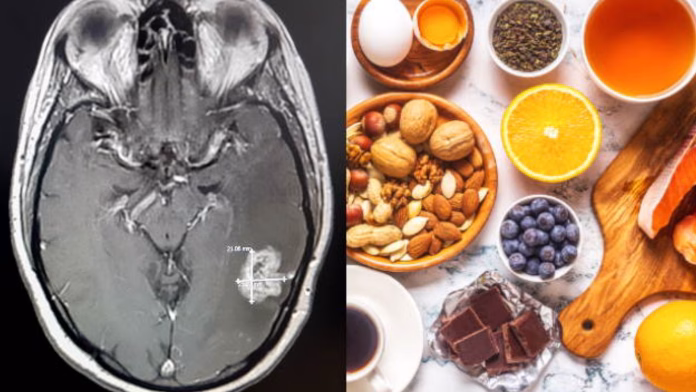 brain tumor food